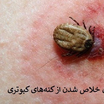 کنترل کنه با مکس فورس