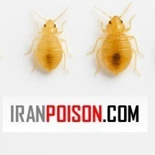 کنترل ساس با پست ساید