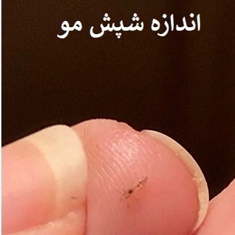 خرید سم شپش پر مکترین با کیفیت