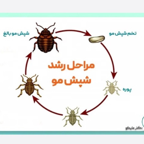 سم شپش کش مو و محیط پرمکترین مبارز قوی شپش ارسال رایگان